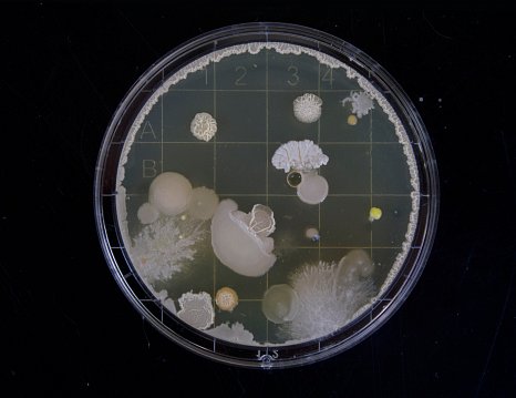 Are we really at Risk from Hospital Superbugs?